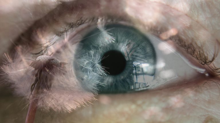L'oeil et les allergies saisonnières